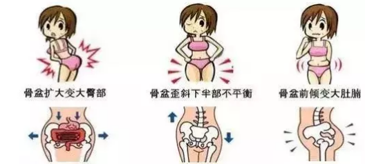 有没有做过产后骨盆修复的宝妈,你们觉得怎么样有效果